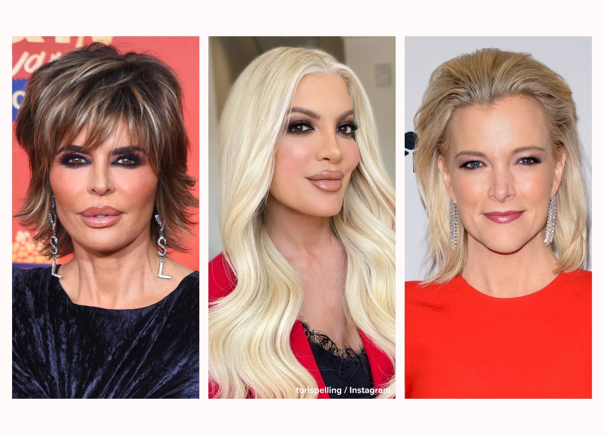 This Month in Aesthetics: Lisa Rinna Says Skinvive Was “Not Good” for Her, Counterfeit Botox Hits the U.S., Tori Spelling Reveals Mounjaro Weight Loss, and More - article image